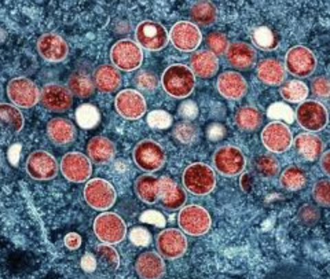 Image of monkeypox bacteria (Creative Commons).